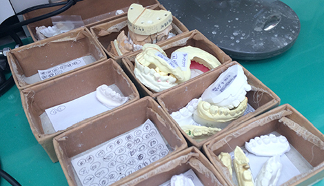 保険外の義歯は、院長が厳選した東京の技工所に製作を依頼しています。